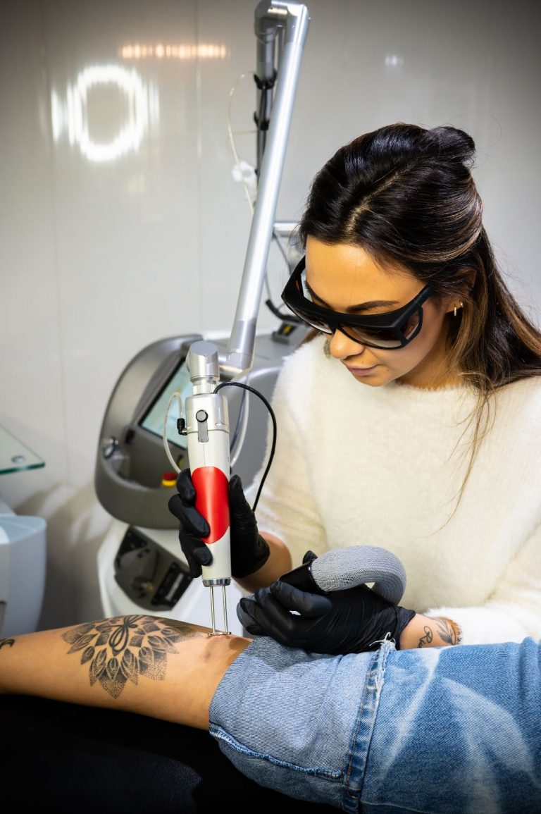Tattoo Removal