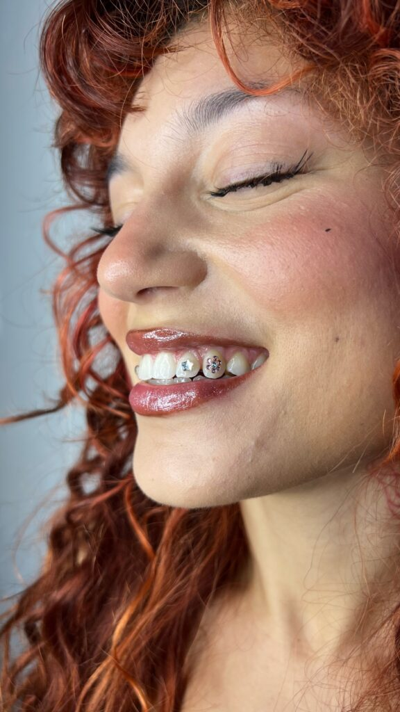 Gouden tooth gems